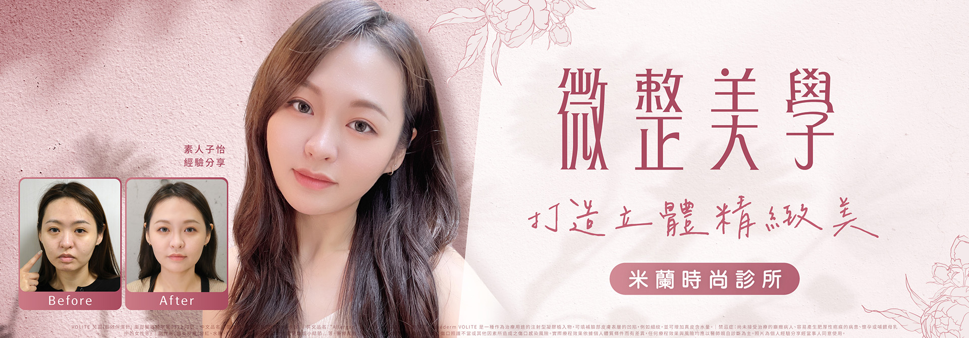 免削骨重現立體精緻美