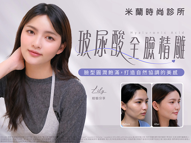 玻尿酸豐頰