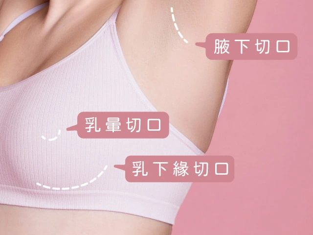 聚焦各式乳房美形手術