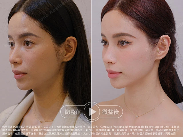 1+1>2 的修復與毛孔對策