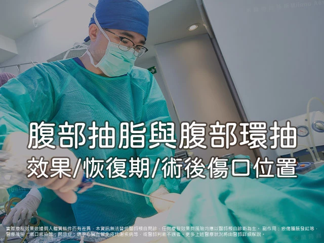 腹部抽脂/腹部環抽推薦