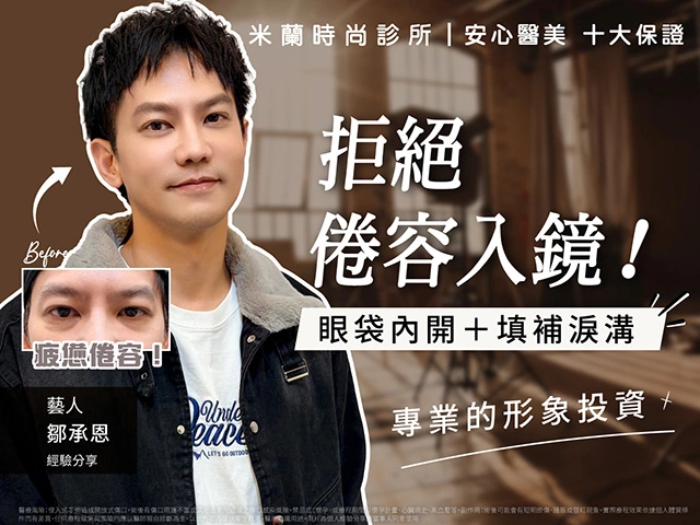 眼袋內開＋淚溝填補完整指南推薦