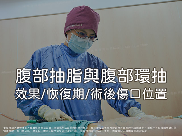 腹部抽脂/腹部環抽推薦