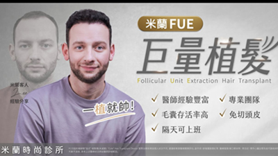 英國型男在台北米蘭的植髮之旅