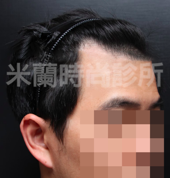 預計種植1100株
