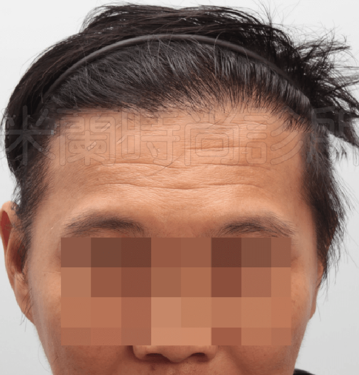 梳往後的髮型