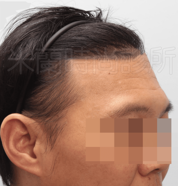 頭髮往後梳密度也相當令人滿意
