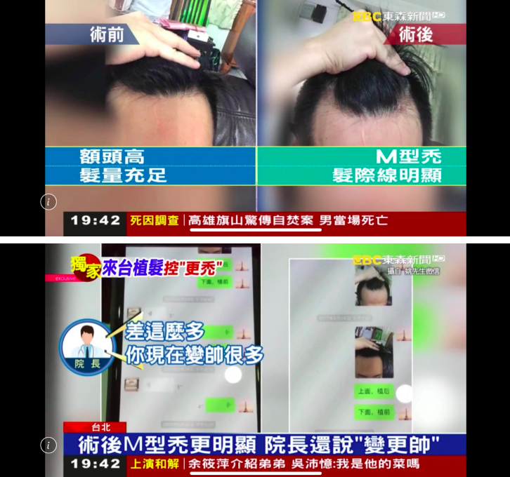診所和患者對於不好的結果