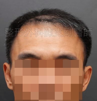 FUT｜此示意圖