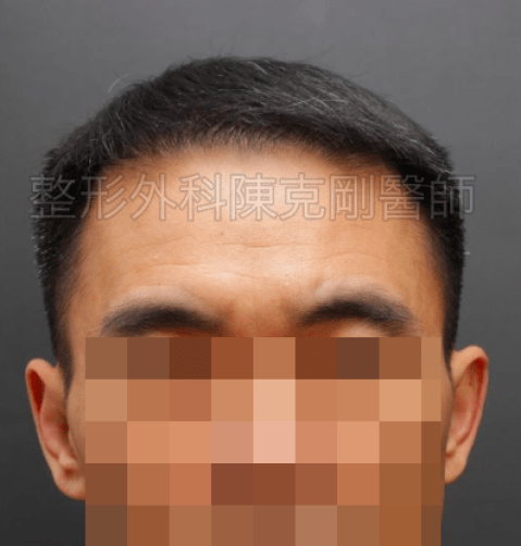 FUT｜此示意圖