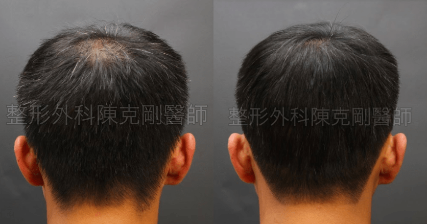 FUT｜此示意圖