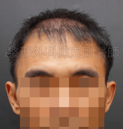 FUT｜此示意圖
