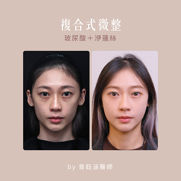 健美選手Aimee偷偷變美解密大公開