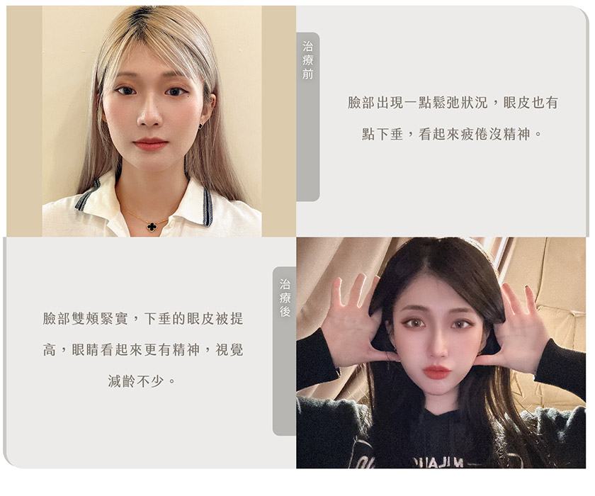 薇安雙波拉提經驗分享