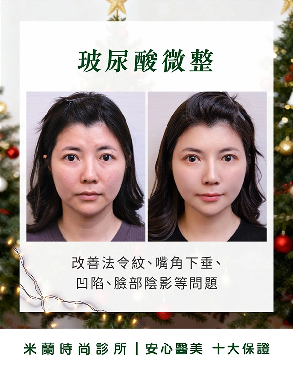 素人YUKI術前術後比一比