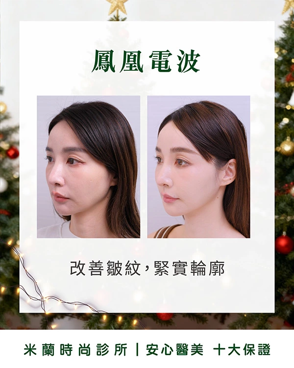模特KOL彭彭經驗分享
