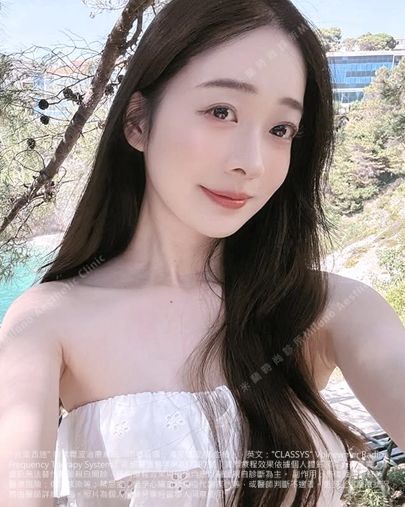 海芙電波效果術後二個月影片分享