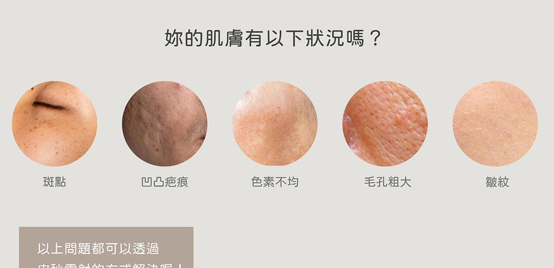皮秒雷射原理