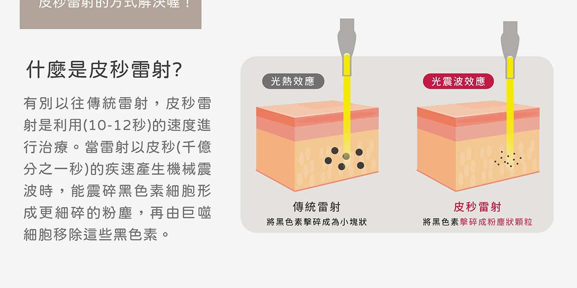 皮秒雷射原理