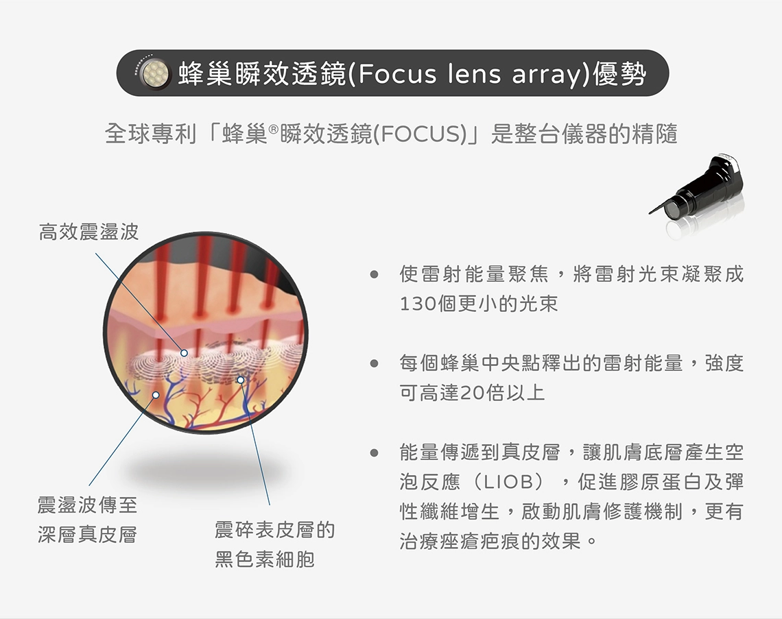 皮秒雷射原理