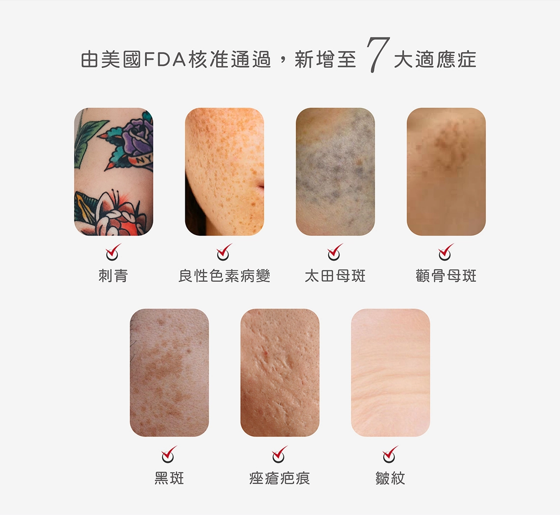 皮秒雷射原理