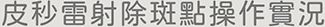 皮秒雷射除斑點操作實況