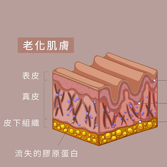 老化的肌膚圖示