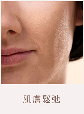 臉部老化示意圖