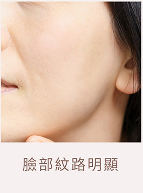 臉部老化示意圖
