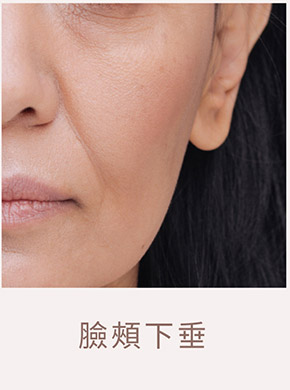 臉部老化示意圖