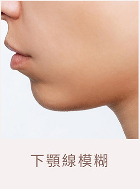 臉部老化示意圖