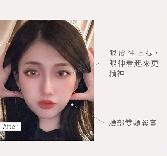 鳳凰電波術後