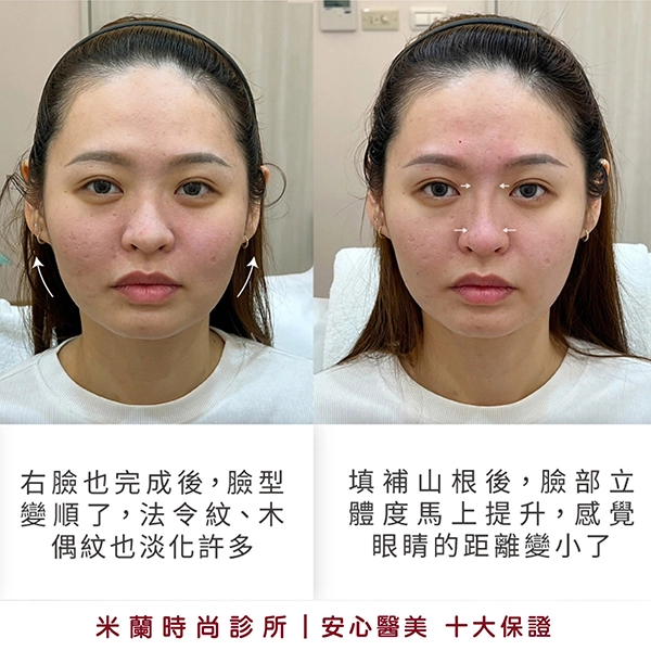 右臉完成 (階段性提升)