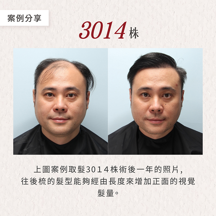 醫師解答