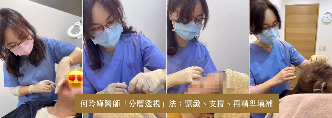 最後才精準填補