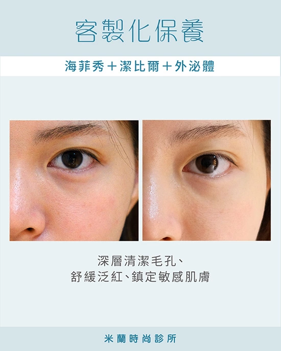 海菲秀+潔比爾+外泌體