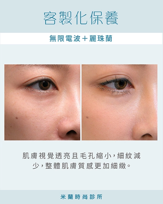 無限電波+麗珠蘭