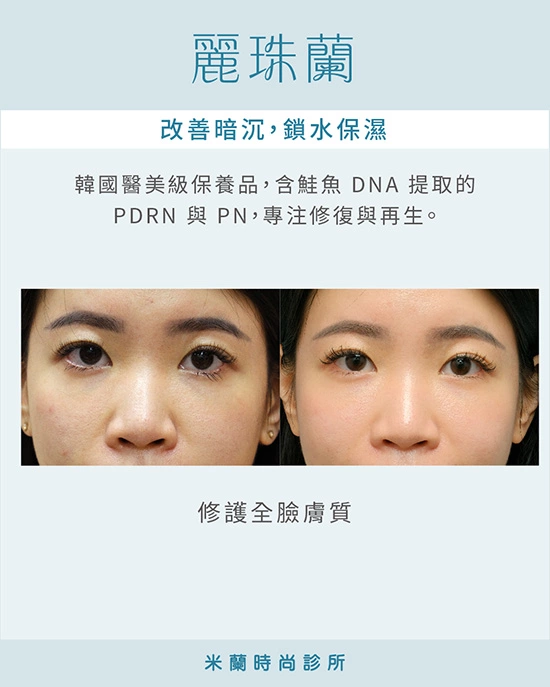 麗珠蘭