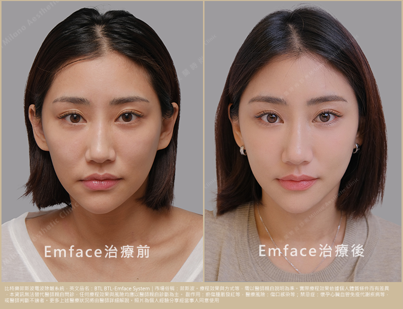 術前術後比一比 照片