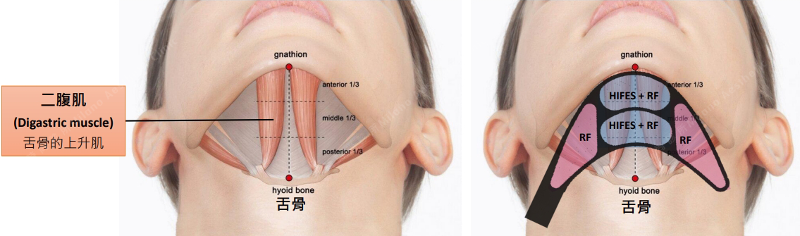 僅作用於二腹肌