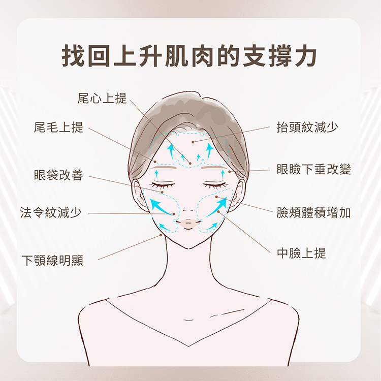 找回上升肌肉支撐力