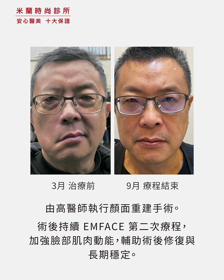 5月9月對比照