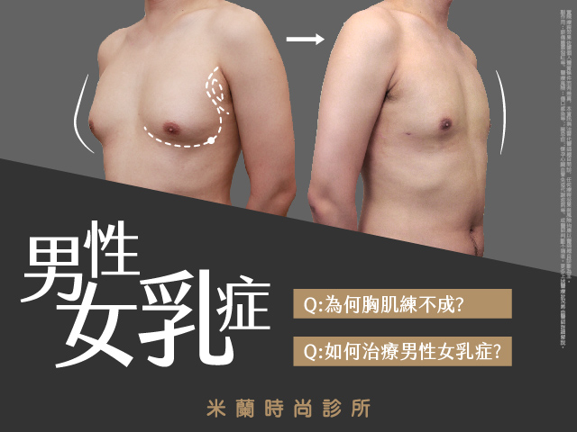 貴婦包團指定 曾鈺涵醫師