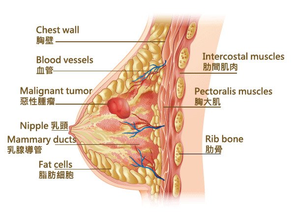 植體植入位置常見為筋膜層或胸大肌之下 封面圖片