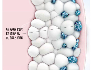 step.3 治療14天後　圖片