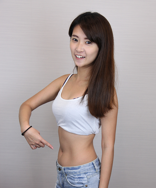 小安 體外減脂 酷思塑平®冷凍減脂 圖片