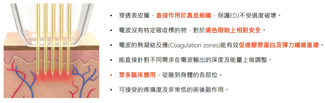 圖片為無限電波廠商提供