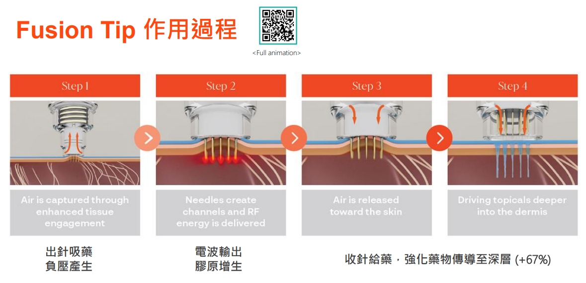 圖片為無限電波廠商提供
