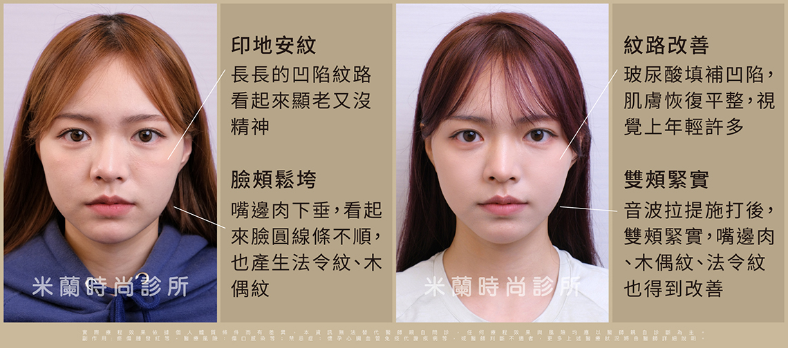 術前術後比較