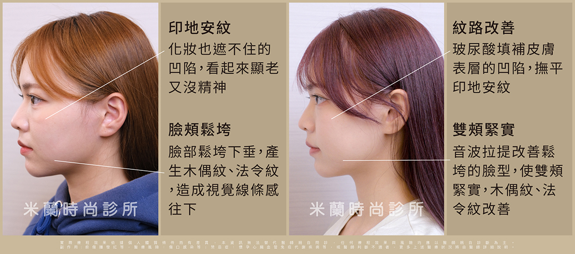 術前術後比較